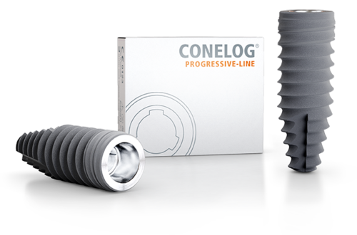 CONELOG PROGRESSIVE-LINE Implants – Developed to facilitate immediate treatment